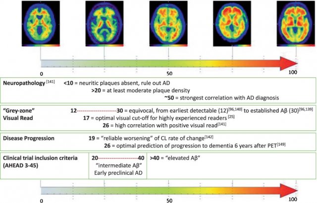 Click image for enlarged view. Source: Pemberton, Eur J Nucl Med Mol Imaging 2022